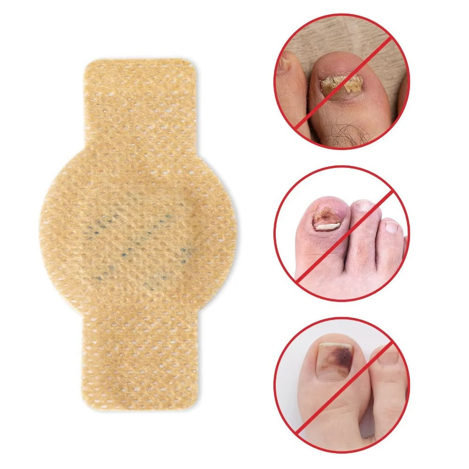 Fungal Nail Patches